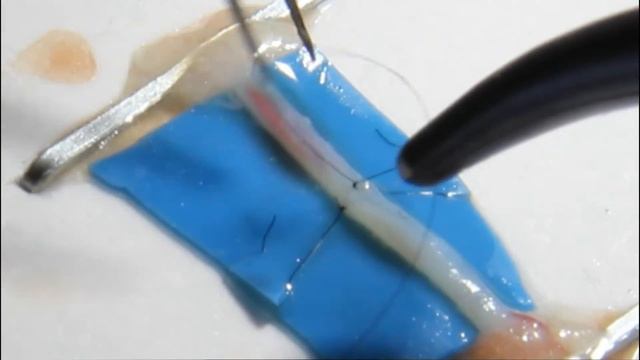 Микрососудистый анастомоз. Microvascular Anastomosis