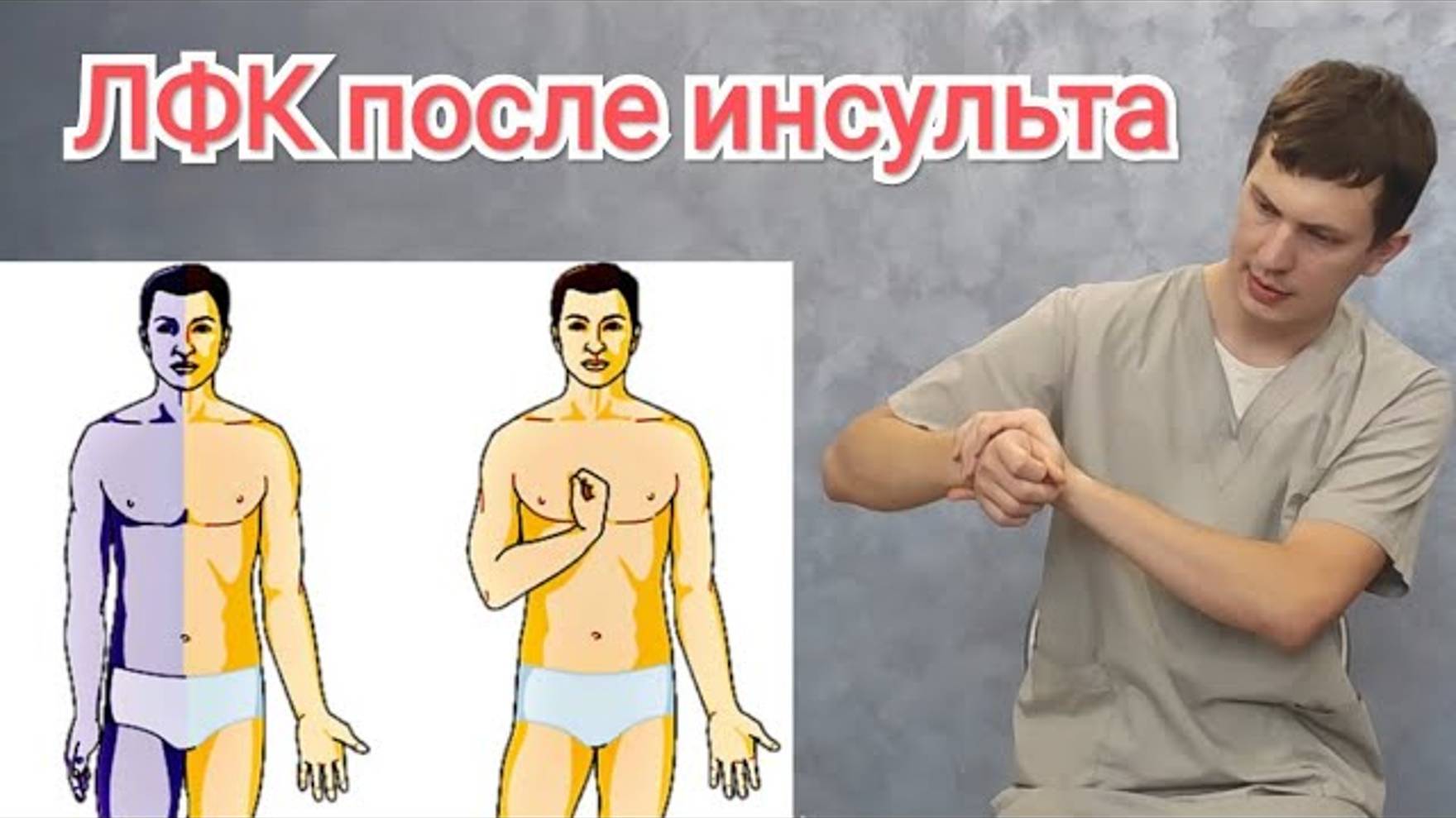 Упражнения для руки после инсульта - ЛФК при инсульте, парезе смотреть онлайн