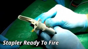 Cosmetic Circumcision Surgery| Painless Penis Treatment in Valsad, Vapi, Kosamba, Surat, Gujarat