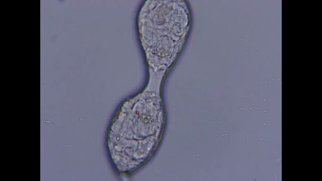 Капля воды под микроскопом из городского озера. смотреть онлайн