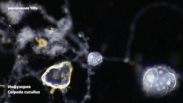 Красивое рождение инфузории рода Colpoda Cucullus смотреть онлайн