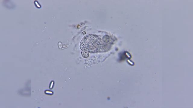 КАК ПОГИБАЕТ ИНФУЗОРИЯ ПОД МИКРОСКОПОМ смотреть онлайн