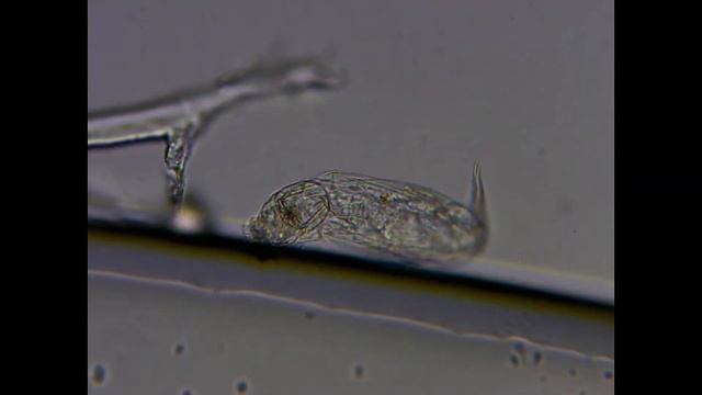 Коловратка под микроскопом - Увеличение 400х смотреть онлайн