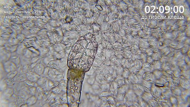 Угревая Железница Demodex | Как мазь Оксолин убивает клеща смотреть онлайн