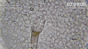 Угревая Железница Demodex | Как мазь Оксолин убивает клеща