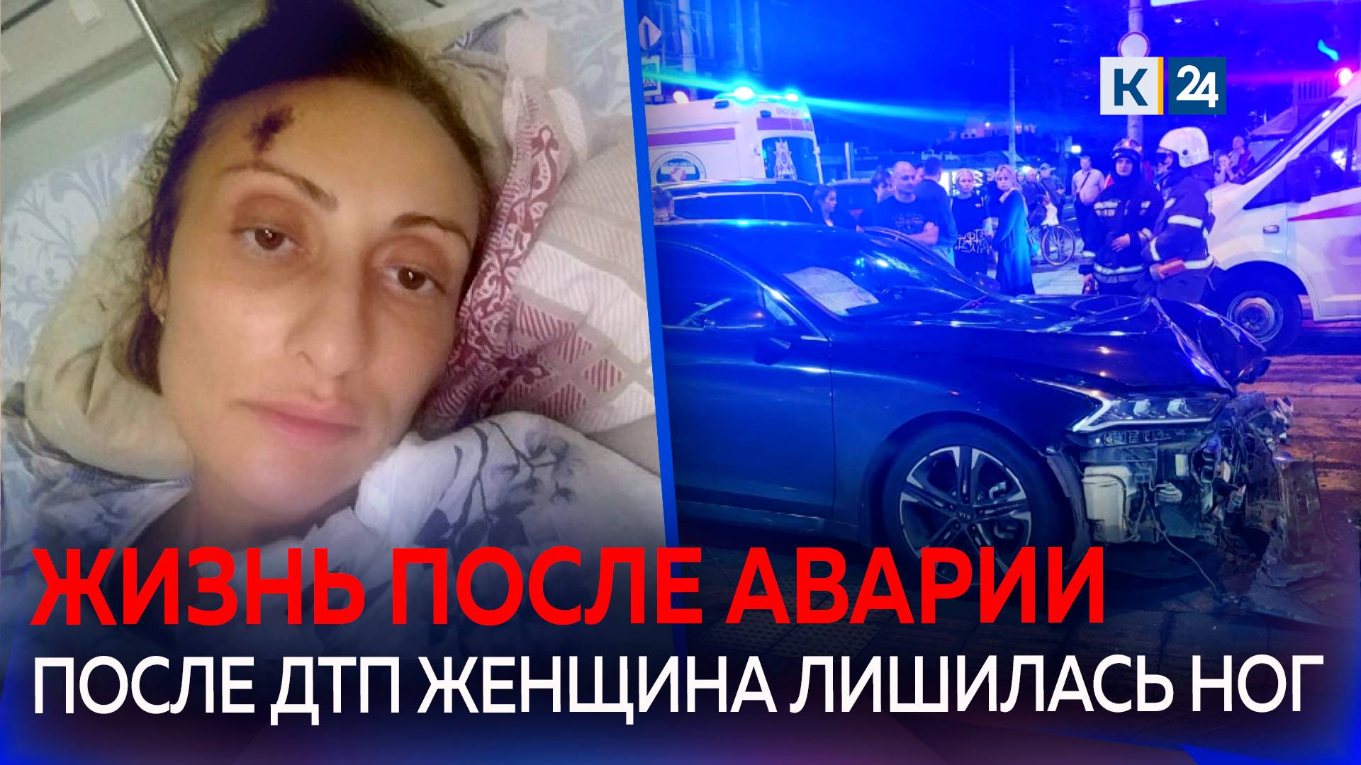 Женщине, сбитой иномаркой на тротуаре в Краснодаре, ампутировали ноги смотреть онлайн
