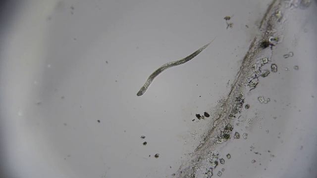 СПИРТ И ХЛОРГЕКСИДИН ПРОТИВ НЕМАТОДЫ | ВЫЖИВУТ НЕМАТОДЫ ПОСЛЕ ОБРАБОТКИ АНТИСЕПТИКОВ смотреть онлайн