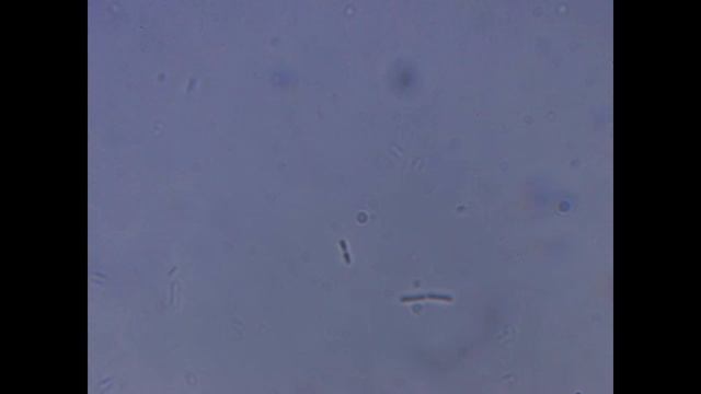 Удивительный мир в капле воды из лужи под микроскопом. Микробы и бактерии под микроскопом. смотреть онлайн