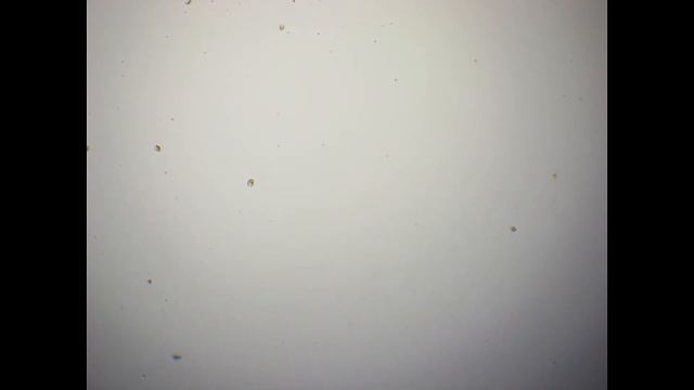 СПИРТ - БЕСПОЩАДНЫЙ УБИЙЦА МИКРОБОВ | КАК СПИРТ УБИВАЕТ МИКРОБОВ ПОД МИКРОСКОПОМ смотреть онлайн