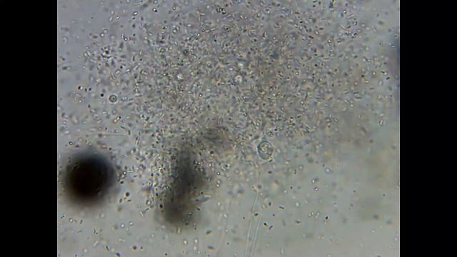 Колония бактерий под микроскопом - Капля воды из озера смотреть онлайн