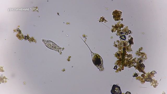 Микробы в озере под микроскопом # 1 смотреть онлайн