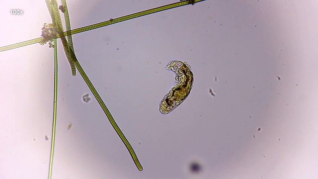 Коловратка под микроскопом - Rotifera смотреть онлайн