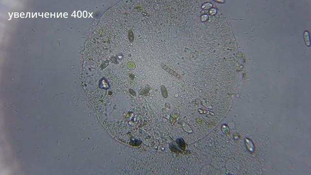 СМЕРТЬ И РОЖДЕНИЕ КЛЕТКИ ПОД МИКРОСКОПОМ - НЕОБЫЧНЫЙ КАДР смотреть онлайн