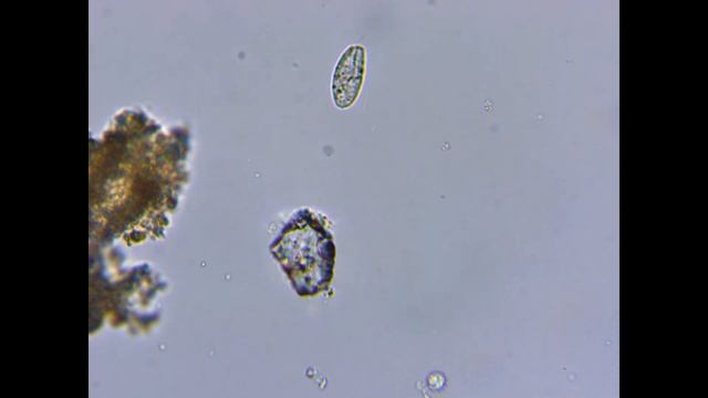 БУРНАЯ ЖИЗНЬ В КАПЛЕ ВОДЫ ИЗ ГОРОДСКОГО ОЗЕРА ПОД МИКРОСКОПОМ смотреть онлайн