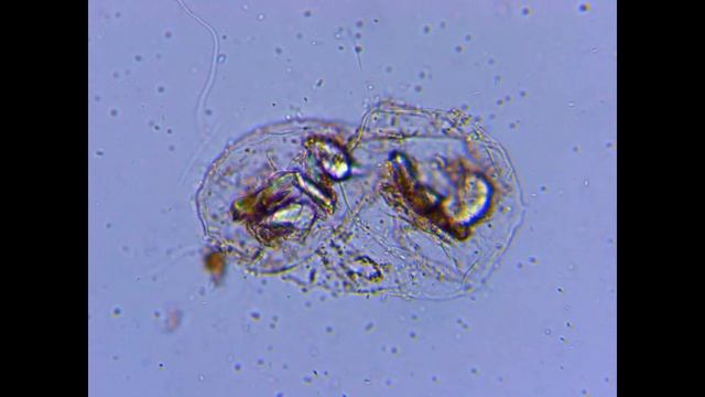 РАЗНООБРАЗНАЯ ЖИЗНЬ В КАПЛЕ ВОДЫ ПОД МИКРОСКОПОМ ИЗ ОЗЕРА смотреть онлайн