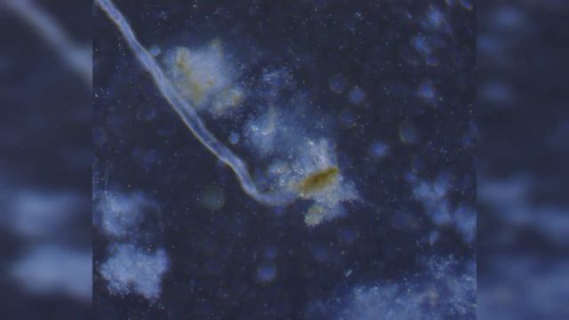 КАК ЭФФЕКТИВНО ЙОД УБИВАЕТ БАКТЕРИИ | ВЗГЛЯНЕМ ПОД МИКРОСКОП смотреть онлайн