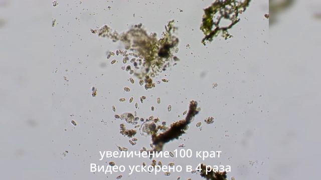 Спирт и перекись водорода - что лучше справляется с микробами? смотреть онлайн
