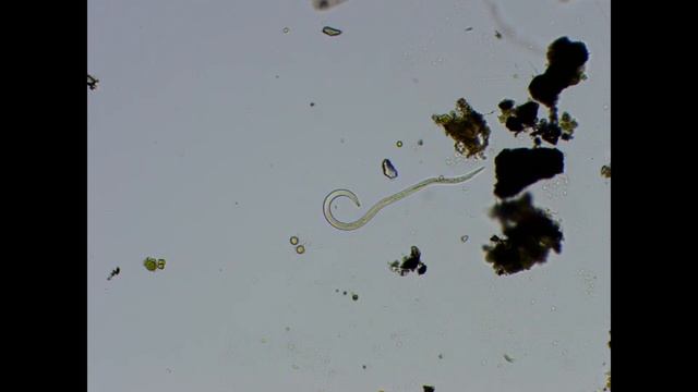 Нематоды под микроскопом смотреть онлайн