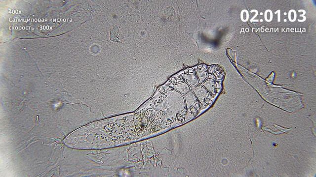 Как салициловая кислота убивает клеща Demodex смотреть онлайн