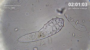 Как салициловая кислота убивает клеща Demodex