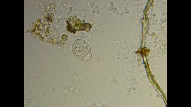 Еще один удивительный житель в капле воды из озера смотреть онлайн