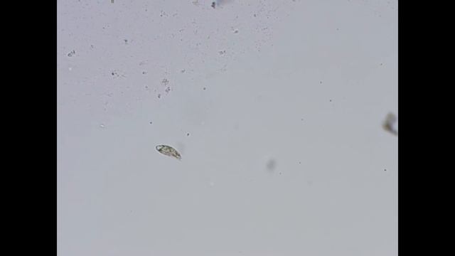 Брюхоресничные инфузории под микроскопом | Hypotricha ciliates смотреть онлайн
