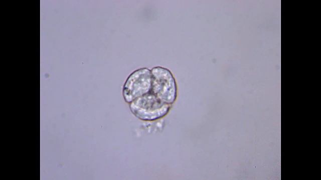 Сразу четыре микроба на свет появились | МИТОЗ - деление, размножение ОДНОКЛЕТОЧНЫХ ПОД МИКРОСКОПОМ смотреть онлайн