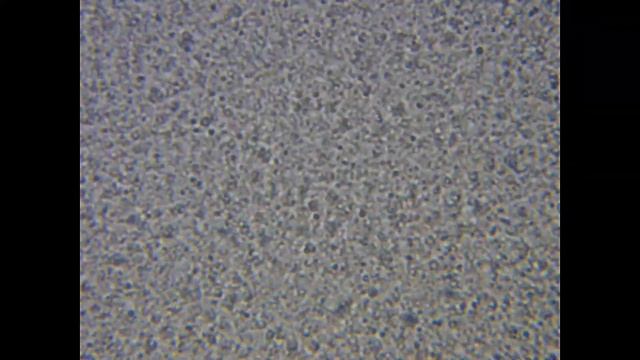 Молоко под микроскопом. смотреть онлайн