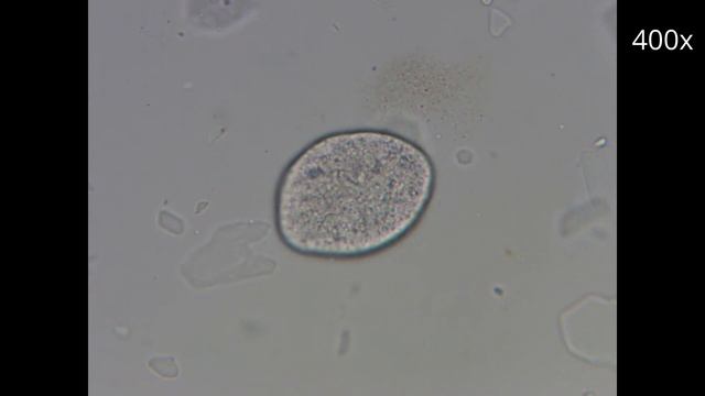 Мёд под Микроскопом. Увеличение 40х 400х. смотреть онлайн