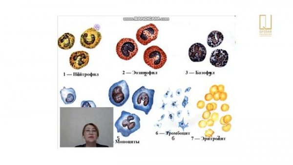 Калиева А. Практикалық сабақ. Лейкоциттер.Тромбоциттер.