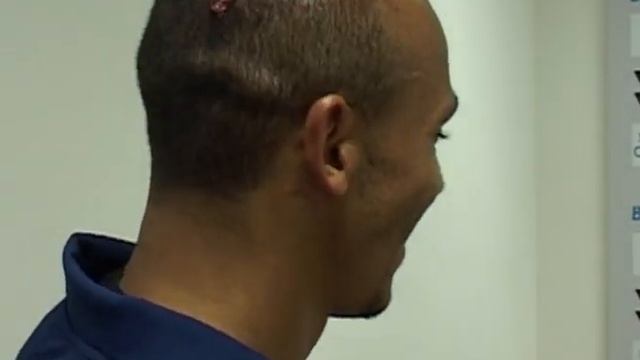 West Bromwich Albion's Odemwingie shows us his war wounds sustained v Liverpool смотреть онлайн