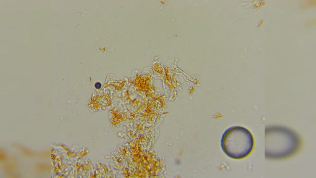 КАК ВЫГЛЯДИТ МАНДАРИН ПОД МИКРОСКОПОМ | МЯКОТЬ И КОЖУРА МАНДАРИНА ПОД МИКРОСКОПОМ смотреть онлайн