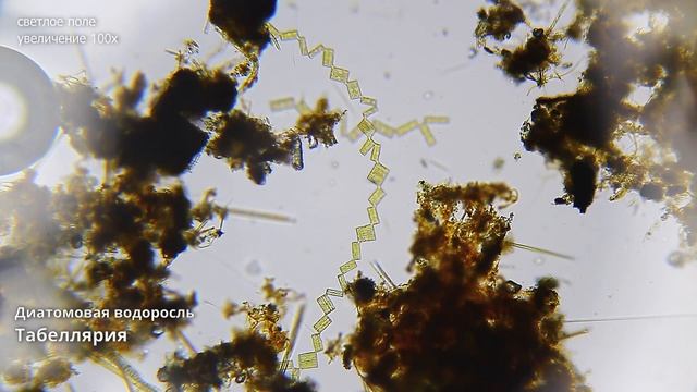 Сколько микробов живет в городском озере? # 2 смотреть онлайн