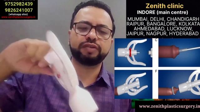 Circumcision In Chandigarh |  ZSR Circumcision Cost In Chandigarh | 2023, ZENITH CLINIC