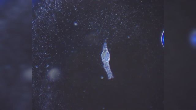 МИКРОКОСМОС - МЕТОД ТЕМНОГО ПОЛЯ | НЕВЕРОЯТНЫЕ КАДРЫ! смотреть онлайн