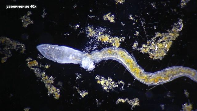 Щетинкобрюхий Червь (Chaetogaster limnaei) и Спирт 96% смотреть онлайн