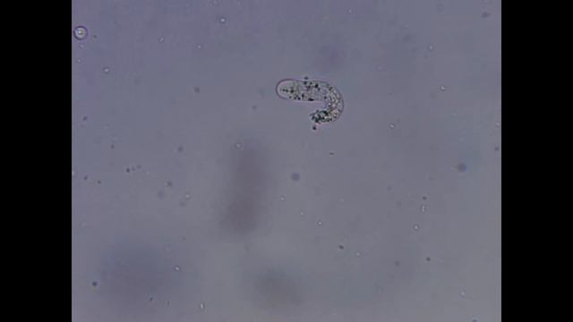 Амеба - Пожирающая наш мозг | Амеба группы LIMAX смотреть онлайн