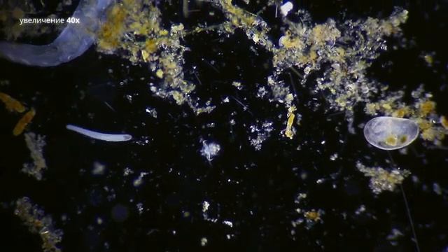 Инфузория - Туфелька | Paramecium caudatum смотреть онлайн