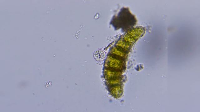КАК РАЗМНОЖАЕТСЯ ИНФУЗОРИЯ КОЛПОДА - Инфузория рода Colpoda смотреть онлайн