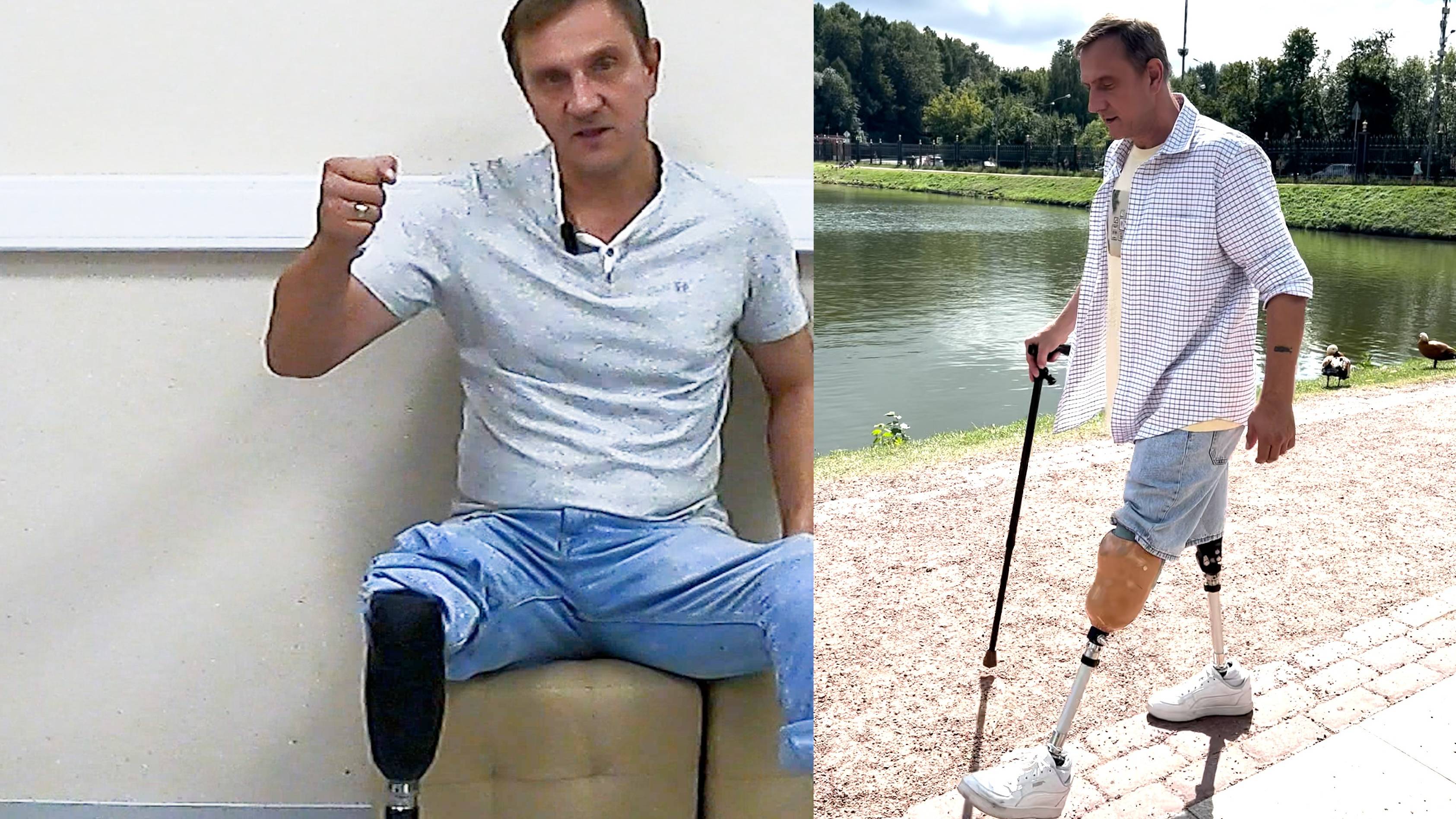 Эпилог. Реабилитация после ампутации ноги: "Многое зависит от Вас" смотреть онлайн