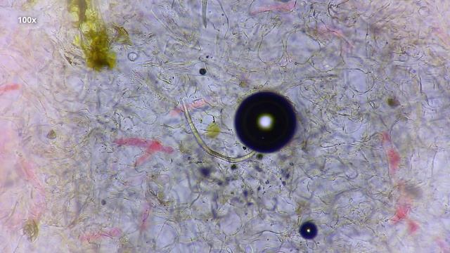 Черви в инжире | 45 миллионов лет нематоды живут в инжире смотреть онлайн