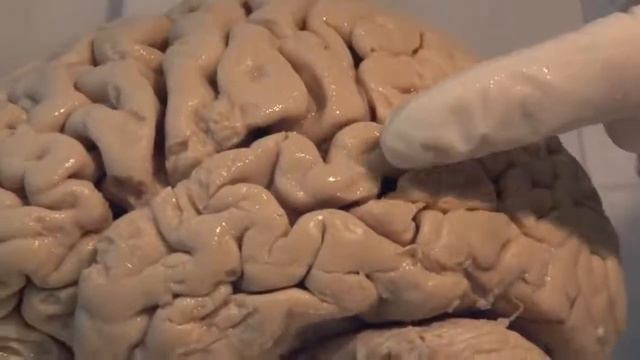 Вскрытие Головного Мозга. смотреть онлайн