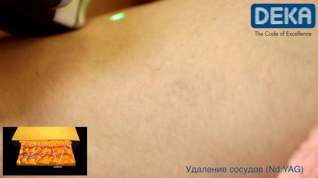Synchro FT смотреть онлайн