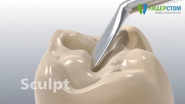 Световая пломба Ivoclar Vivadent