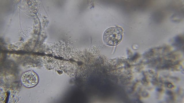 Кто такая Сувойка - Vorticella? Увеличение 400 крат смотреть онлайн