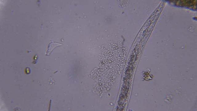 Кто ты, Нематода? КРУГЛЫЕ ЧЕРВИ И ИНТЕРЕСНЫЕ ФАКТЫ О НЕМАТОДАХ | Нематоды под микроскопом смотреть онлайн