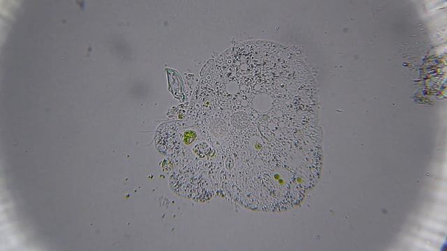 Микробы под микроскопом смотреть онлайн