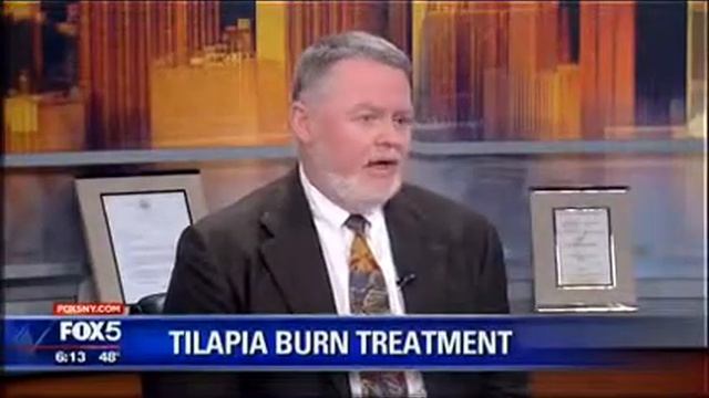 Using Fish Skin to Treat Burns on FOX5 with Dr. James Gallagher смотреть онлайн