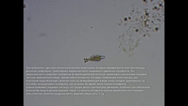 Коловратка в капле воды из озера. Хищная коловратка. смотреть онлайн