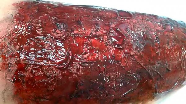 Burn Moulage Tips & Tricks - Nova Southeastern University